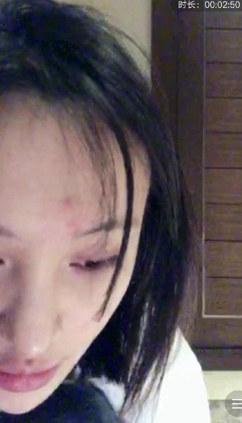 疙瘩吃瓜直播间,揭秘娱乐圈幕后故事